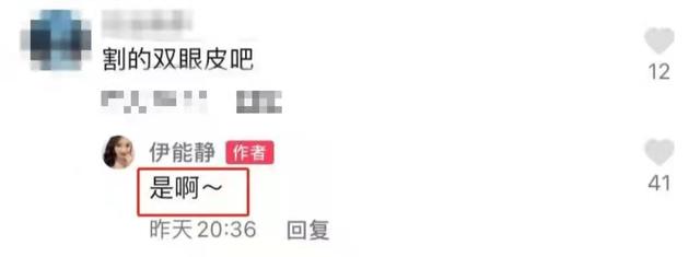六位大方承认整容的明星（脸僵面肿耳变形）(5)
