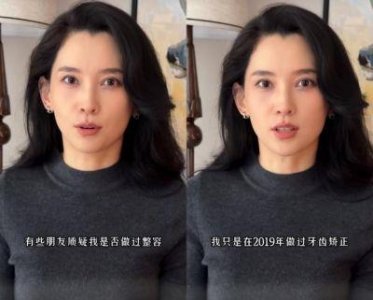 ​冯提莫整容成大妈？红毯现场生图流出，网友：险些认不出